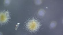 Gloeotrichia echinulata colonies look like pale green to light olive-green pinhead-sized spheres in the water. Photo by Gina LaLiberte/DNR