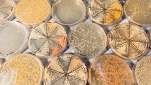 Petri dishes in the Hittinger lab at UW–Madison grow a multitude of wild yeast species. Undiscovered yeast species and engineered yeast hybrids may hold the key to unlocking the biofuel potential of switchgrass and other biomass crops. 